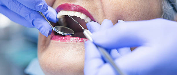 Best Emergency Dental Care for Broken or Chipped Teeth in , CA