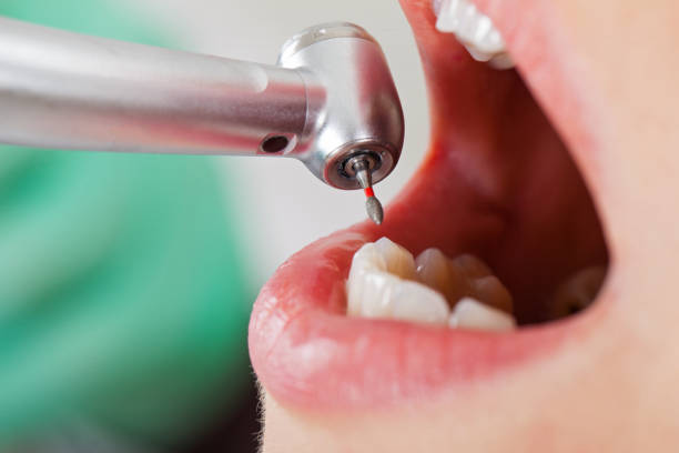 Best Cosmetic Emergency Dentistry in , CA